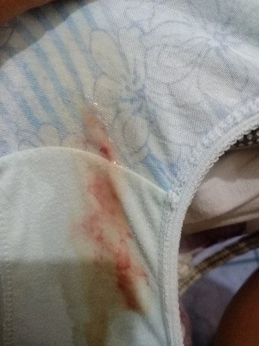 mucus plug na ba to?