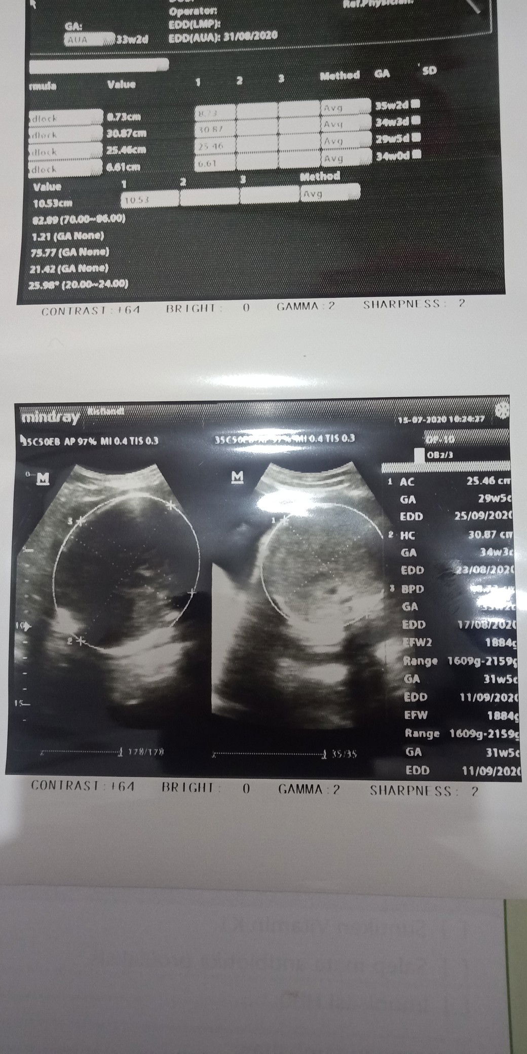 BBJ Kurang Gara2 Mitos