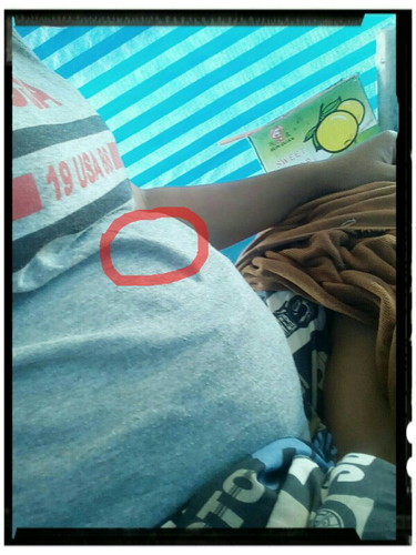 ตอนนี้รู้สึกว่าจุกท้องตรงที่วงไว้มาสองวันแร้วมีแม่บ้านไหนเปนบ้างไหม