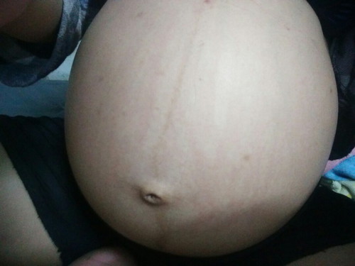 แน่นท้องมากๆ