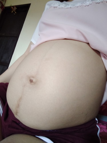 29w ท้องค่อนข้างเล็กลูกนน.978g