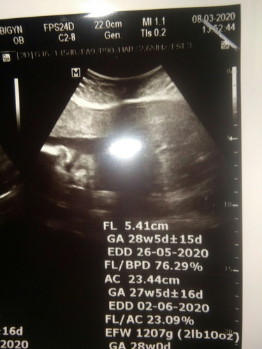 ลูกสาว