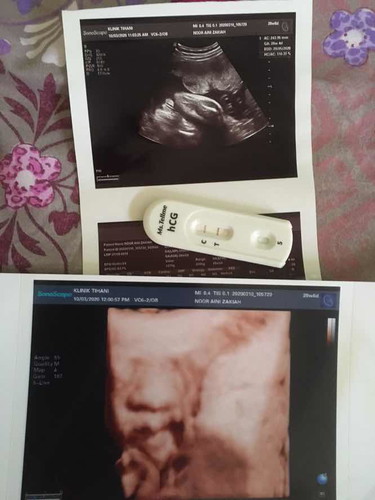 #ANazingparents #AudeliaNaturals