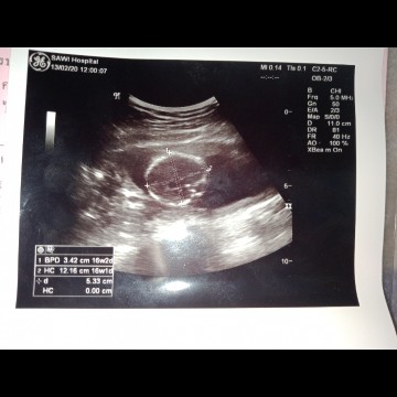 16W2bยังแพ้อยู่เลย