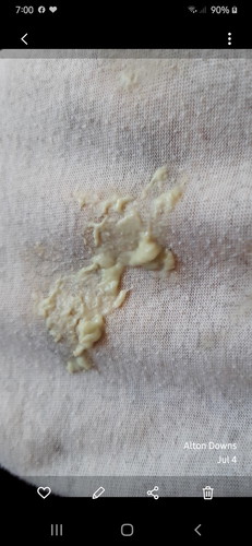 18 weeks preggy,, discharge