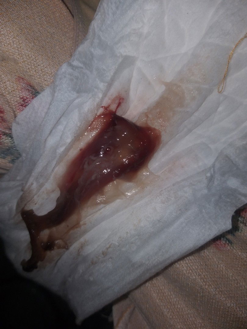 4 cm - 38 weeks, BLOOD SHOW AFTER IE