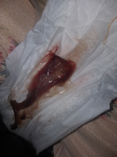 4 cm - 38 weeks, BLOOD SHOW AFTER IE