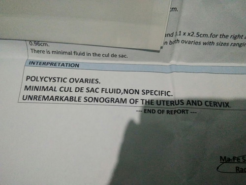 free fluid in cul de sac ?