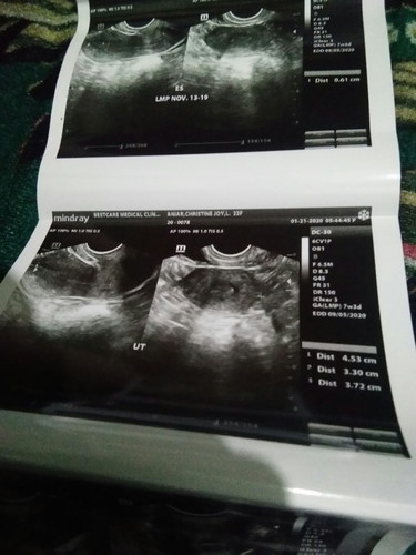 Meron bang laman ?help me po