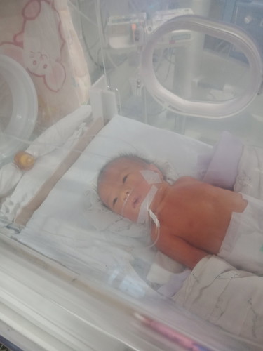 คลอดก่อนกำหนด