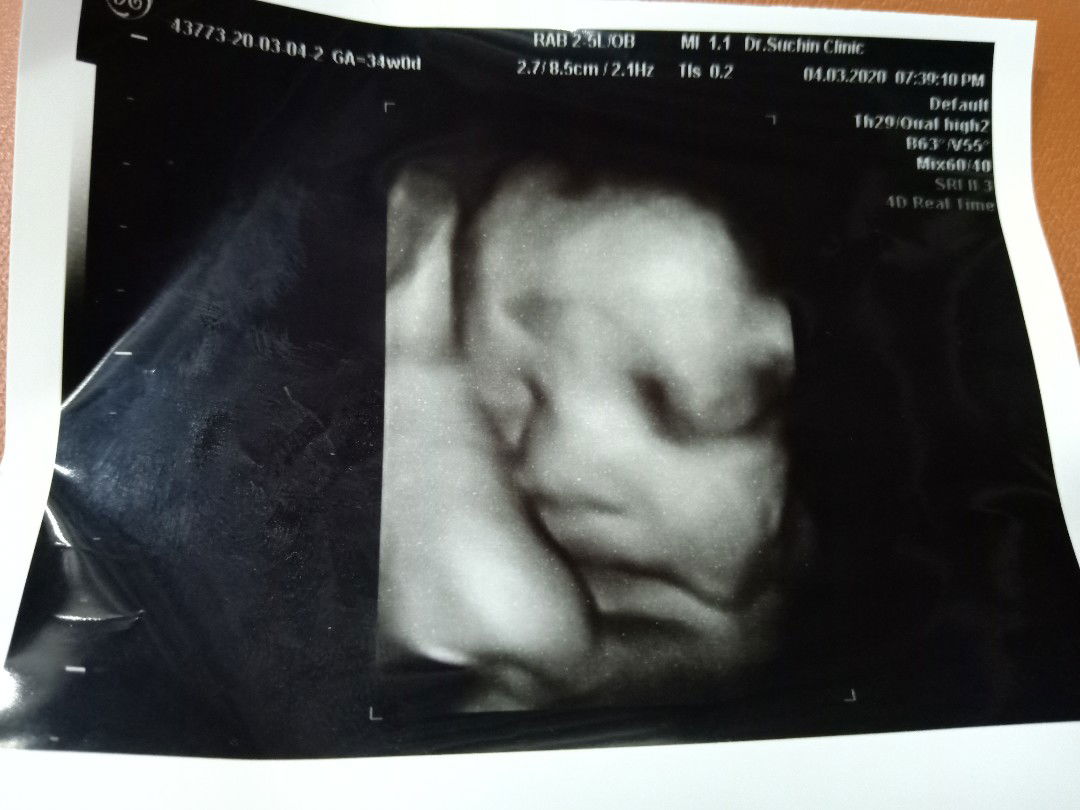 เบบี๋สุดรัก