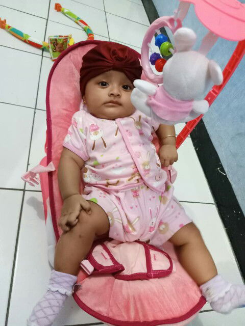 hidung mampet pada bayi