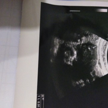 ingin pnya baby