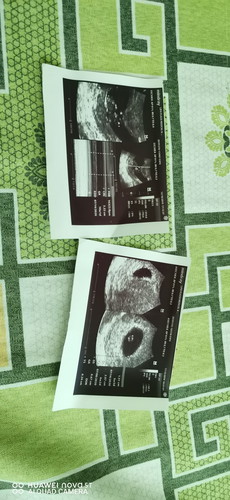 Our First Baby ❤️?