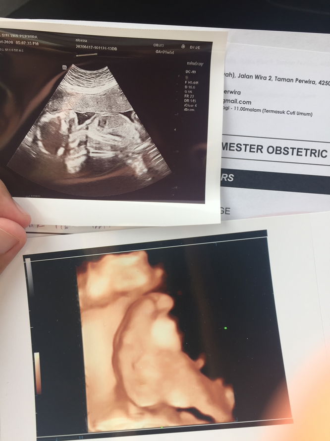 Details & Gender Scan