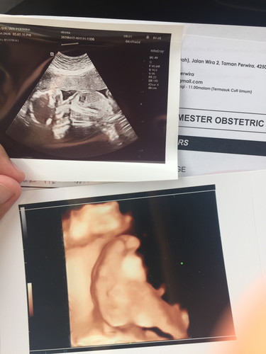 Details & Gender Scan