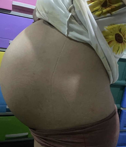 38 weeks pregnant
