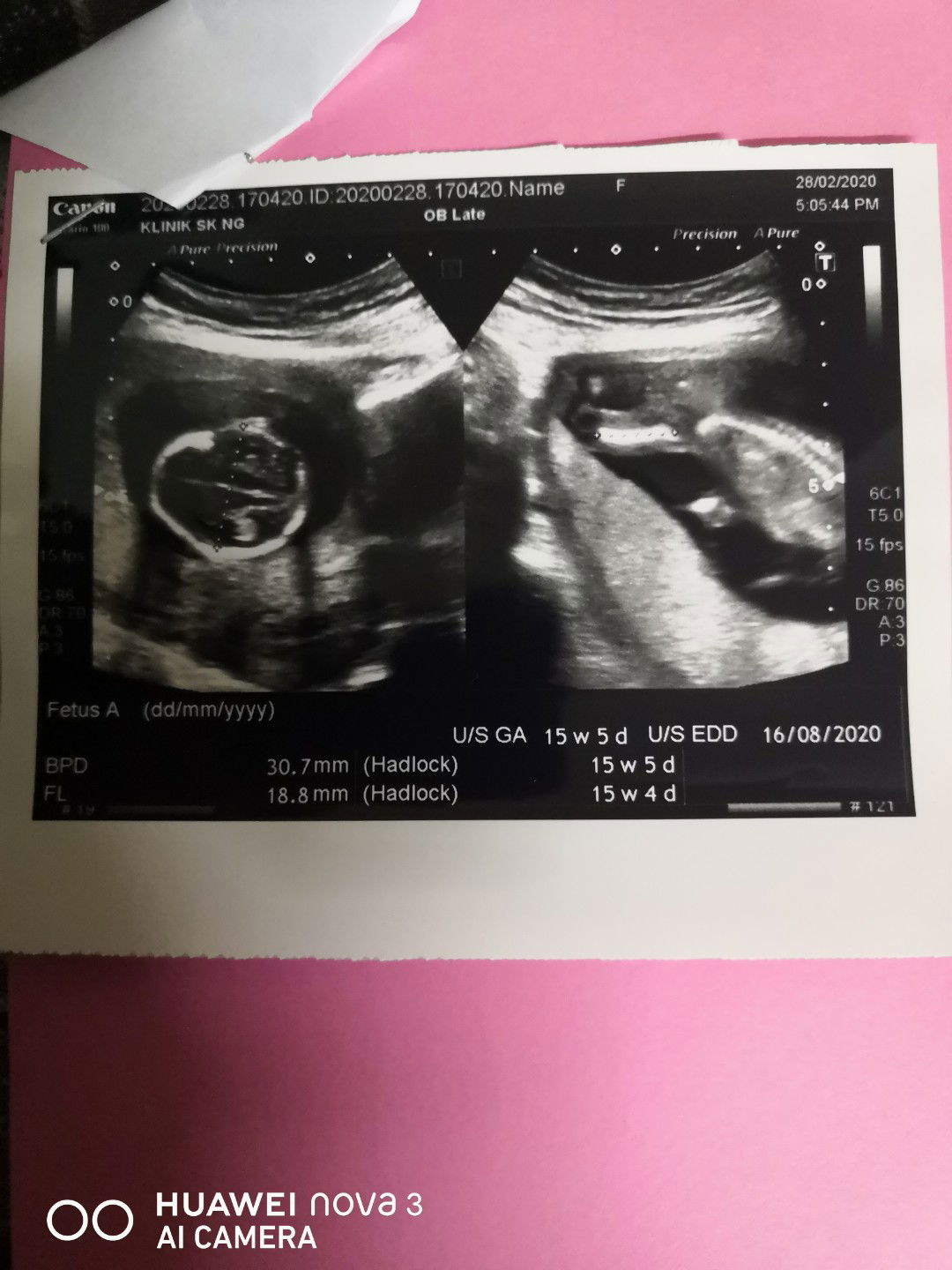 Baby Apa Yea Ni.. ? ? ?