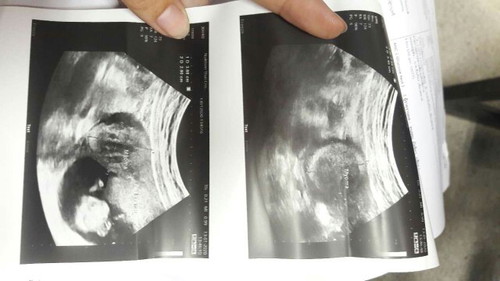 ขอสอบถามหน่อยนะค่ะ