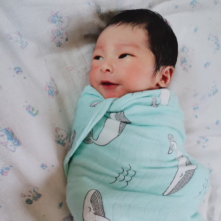 น้องกวินเป็นโรค G6PD.