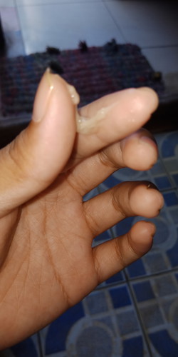 bund...ad yg pngalaman keg sya gk ? sya it pke KB Alamiah. Nah seingat sya brhubungan trakhir saat tdak subur. tapi skarang sya telat 5 hari, hri ke -4 kmaren sya test hasil negatif. ada yg bsa kasih solusi gk bund ? cek lendir wrna ny keg gtu bund..