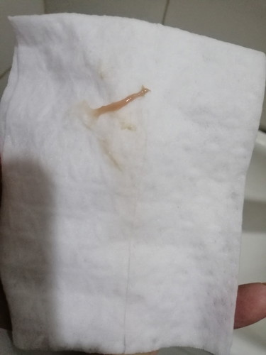 Light Brown Discharge