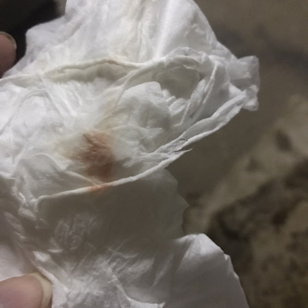 เลือดออกตอนตั้งครรภ์