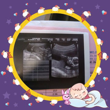 Charlyn Villanueva profile icon