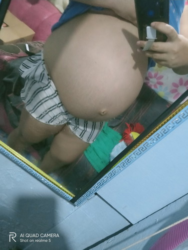 36weeks Napo ako. hi mga mami