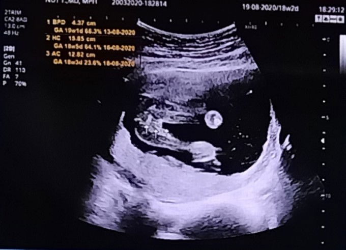 คุณแม่แอบกังวลใจ