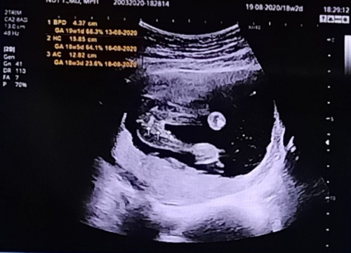 คุณแม่แอบกังวลใจ