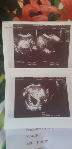 blithed ovum ?