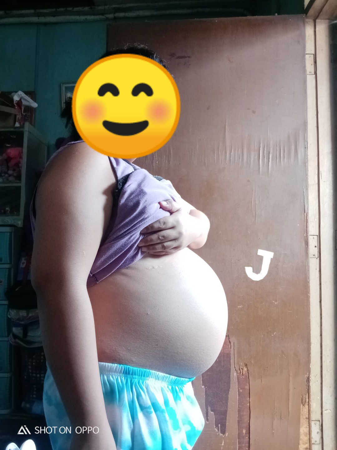 normal lang po ba na matigas ung tyan?