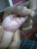 mohon bantuannya bund, ini bintik gejala apa yah