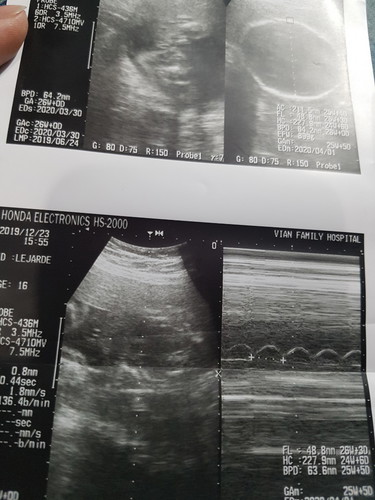 Hi po Ask ko lang po if sure girl po kaya pag sinabi ng doctor na girl daw si baby pero walang nakalagay sa ultrasound na baby girl siya?