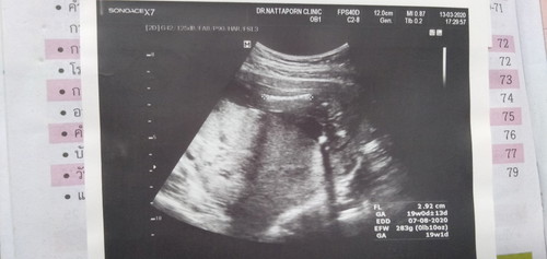 เพศลูก