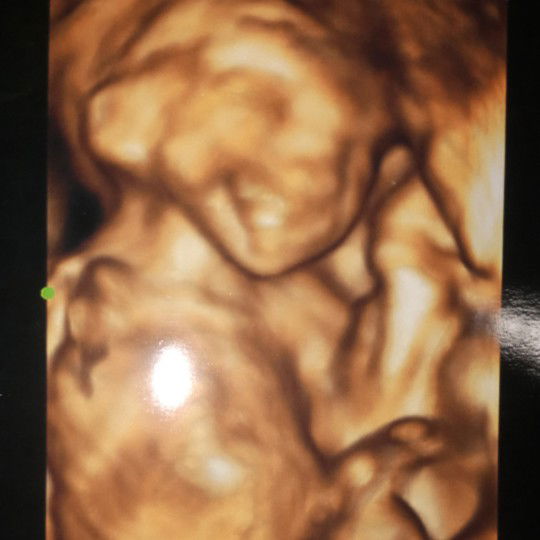 dedenya ketawa girang