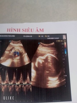 cac m thông thái cho e hoi ,26w bé đc 850g chuẩn chưa ạ