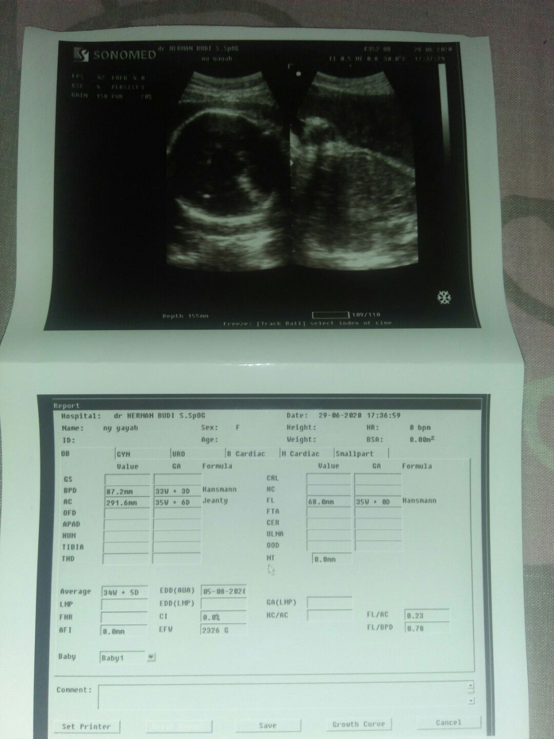 mau tanya female itu cowok apa cewek?