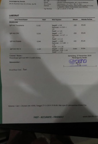 Tes lab toxo