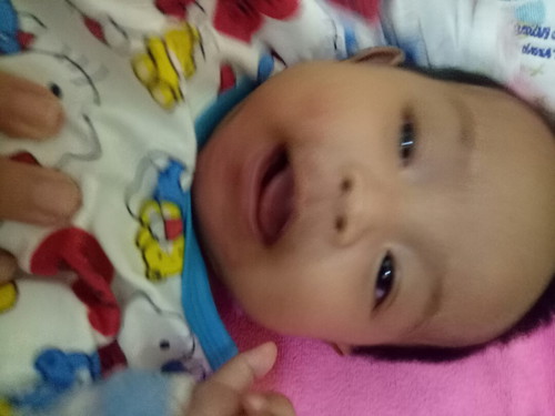 ไม่รู้ว่าแพ้อะไร
