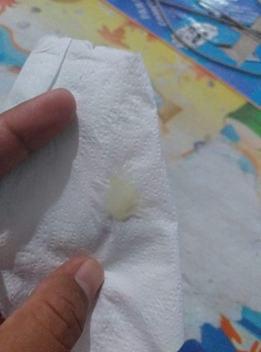 สอบถามค่ะ