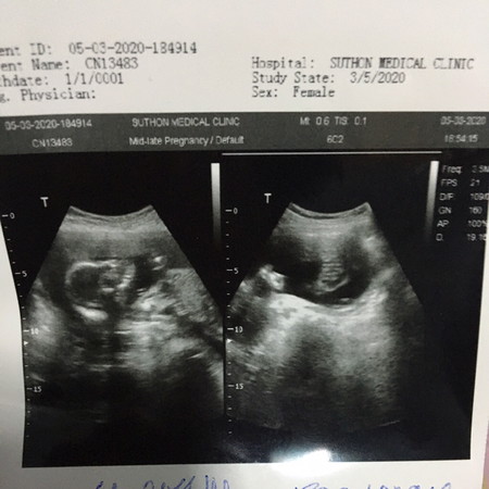 เพศลูก