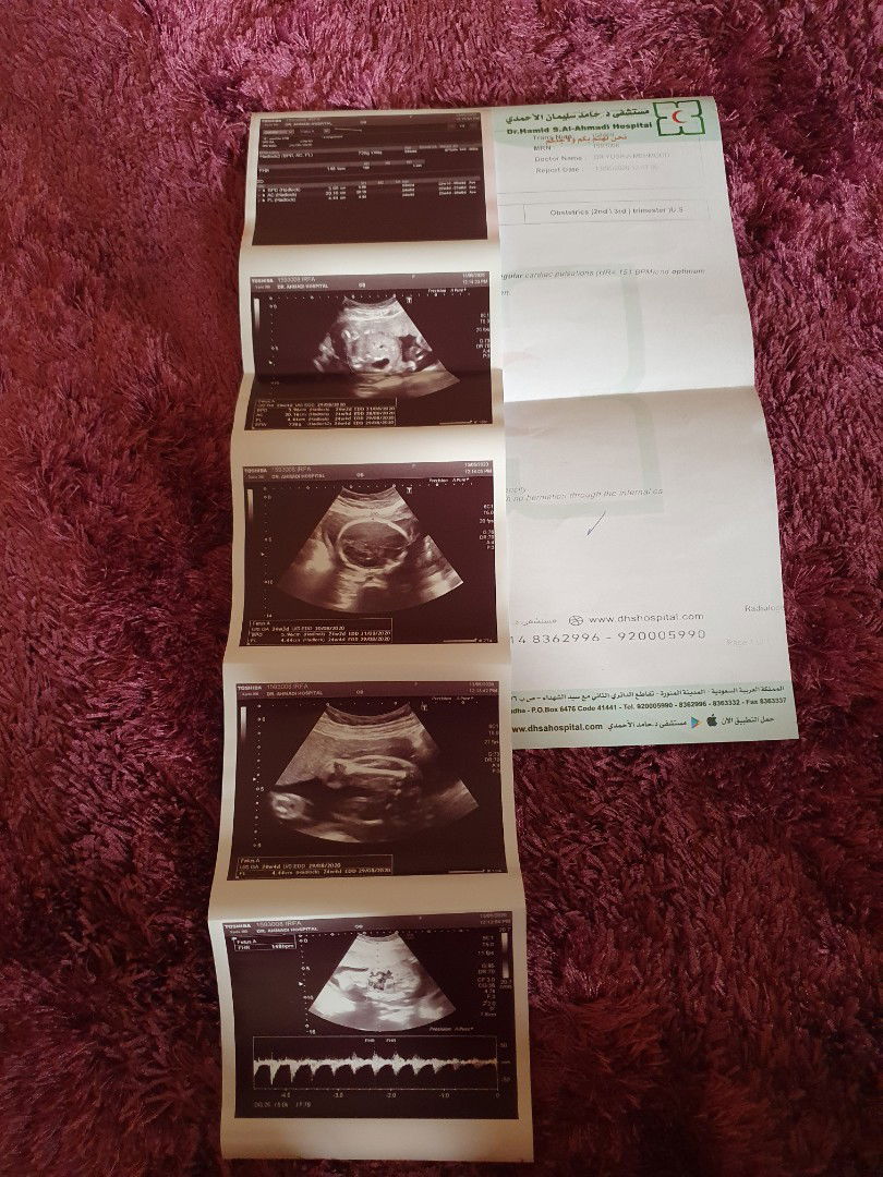 Irva Ade Vira profile icon