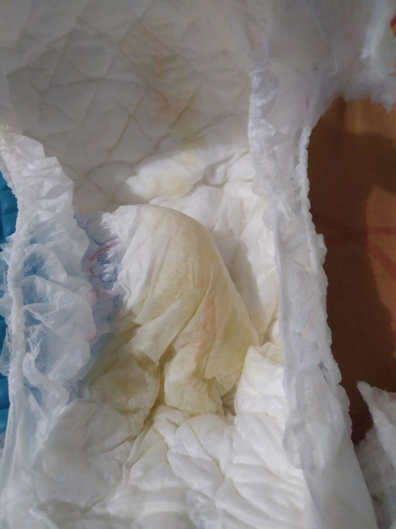 bercak orange di pempers