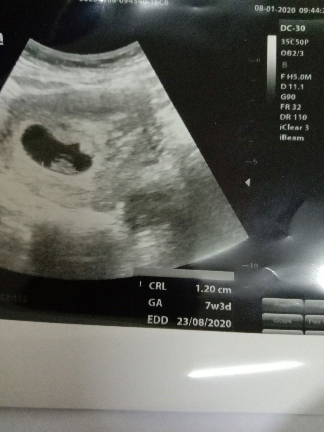 belum terdeteksi detak jantung