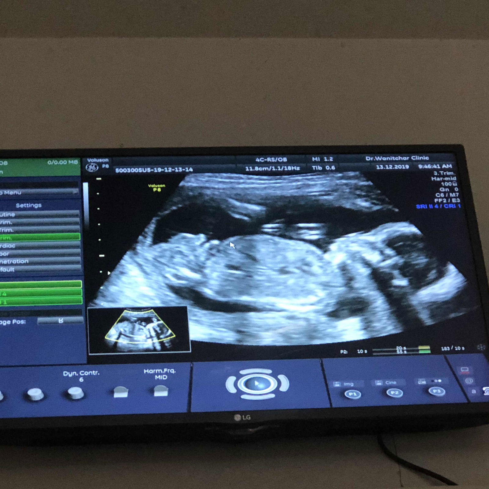 คุงแม่มือใหม่ profile icon