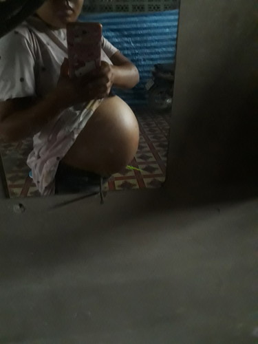 แม่ๆบ้านไหนยังไม่รู้เพศน้องบ้าง