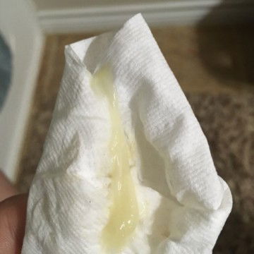 lendir keputihan atau tanda melahirkan ?