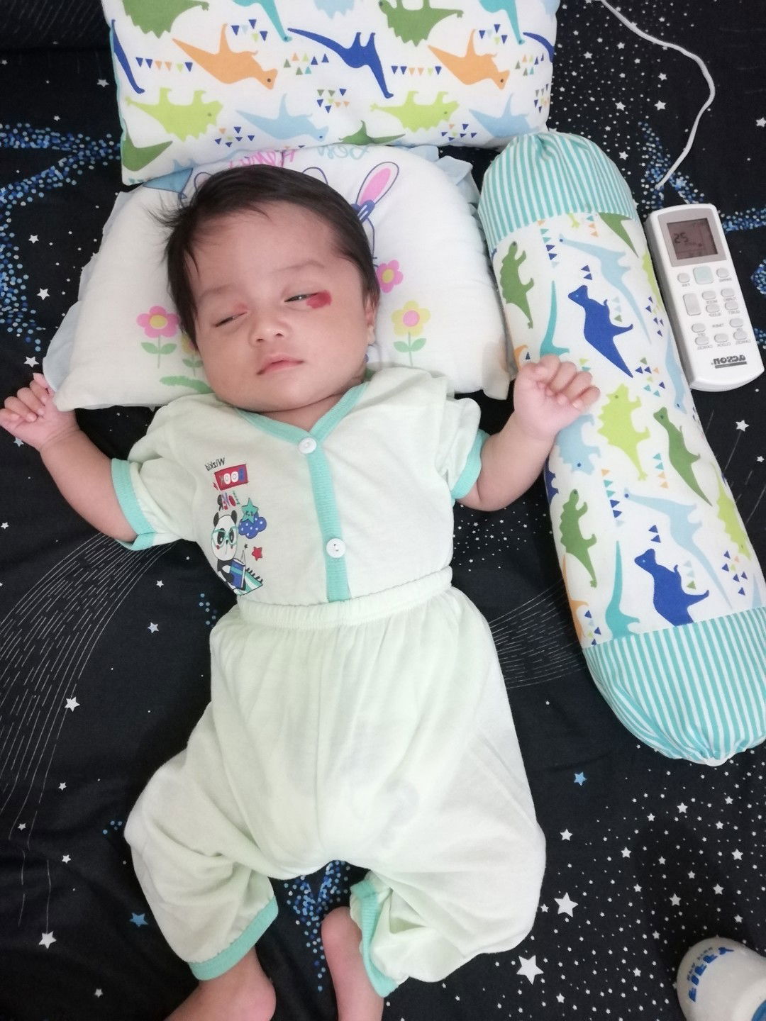 Bawah Mata Baby Warna Kemerahan